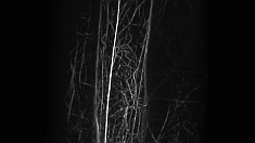 Image from inverted spinning disk